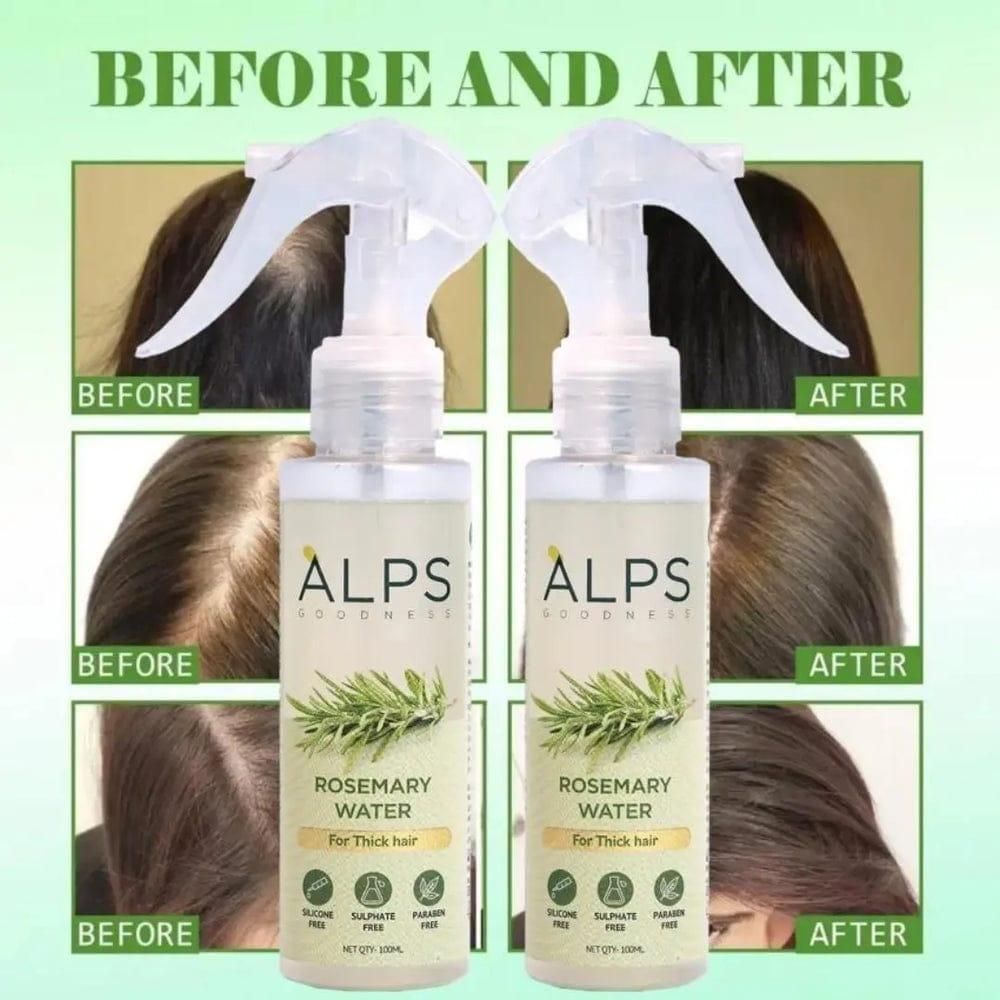 Rosemary Water Hair Spray For Regrowth Buy 1 Get 2 Free